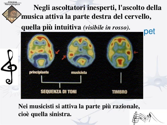 Cervello e musica