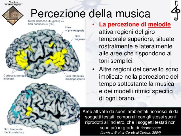 Effetti Negativi Della Musica Sul Cervello Cervello e musica