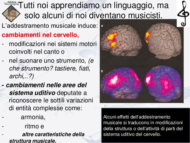 Cervello e musica