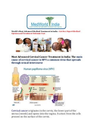 World's Most Advanced Medical Treatment in India - Get free Expert Medical
Opinion and Treatment Estimate Cost
Most Advanced Cervical Cancer Treatment in India: The main
cause of cervical cancer is HPV a common virus that spreads
through sexual intercourse
Cervical cancer originates in the cervix, the lower part of the
uterus (womb) and opens into the vagina. It arises from the cells
present on the surface of the cervix.
 