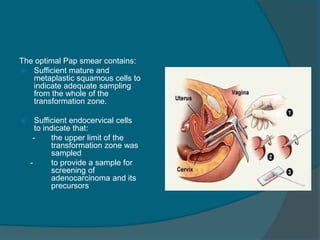 The optimal Pap smear contains:
 Sufficient mature and
metaplastic squamous cells to
indicate adequate sampling
from the whole of the
transformation zone.
 Sufficient endocervical cells
to indicate that:
- the upper limit of the
transformation zone was
sampled
- to provide a sample for
screening of
adenocarcinoma and its
precursors
 