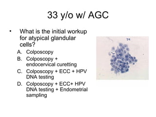 33 y/o w/ AGC What is the initial workup for atypical glandular cells? Colposcopy Colposcopy + endocervical curetting Colposcopy + ECC + HPV DNA testing Colposcopy + ECC+ HPV DNA testing + Endometrial sampling 