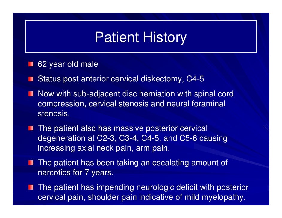 case-review-5-62-year-old-male-with-degenerative-disc-disease-c2c6-2-728.jpg?cb=1343660357