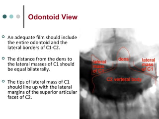Odontoid View
 An adequate film should include
the entire odontoid and the
lateral borders of C1-C2.
 The distance from the dens to
the lateral masses of C1 should
be equal bilaterally.
 The tips of lateral mass of C1
should line up with the lateral
margins of the superior articular
facet of C2.
 