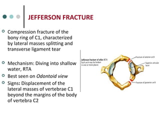 JEFFERSON FRACTURE
 Compression fracture of the
bony ring of C1, characterized
by lateral masses splitting and
transverse ligament tear
 Mechanism: Diving into shallow
water, RTA
 Best seen on Odontoid view
 Signs: Displacement of the
lateral masses of vertebrae C1
beyond the margins of the body
of vertebra C2
 