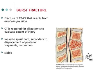 BURST FRACTURE
 Fracture of C3-C7 that results from
axial compression
 CT is required for all patients to
evaluate extent of injury
 Injury to spinal cord, secondary to
displacement of posterior
fragments, is common
 stable
 