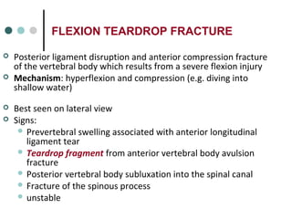 FLEXION TEARDROP FRACTURE
 Posterior ligament disruption and anterior compression fracture
of the vertebral body which results from a severe flexion injury
 Mechanism: hyperflexion and compression (e.g. diving into
shallow water)
 Best seen on lateral view
 Signs:
 Prevertebral swelling associated with anterior longitudinal
ligament tear
 Teardrop fragment from anterior vertebral body avulsion
fracture
 Posterior vertebral body subluxation into the spinal canal
 Fracture of the spinous process
 unstable
 