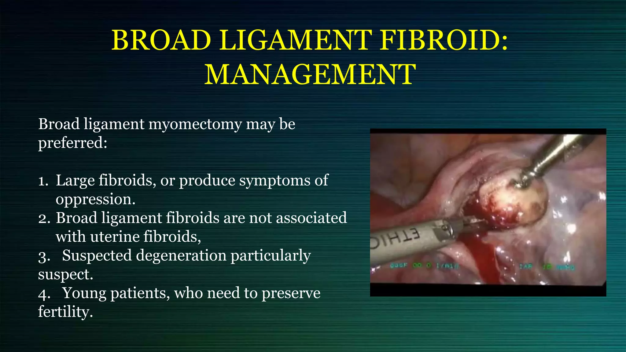 Broad ligament myomectomy may be
preferred:
1. Large fibroids, or produce symptoms of
oppression.
2. Broad ligament fibroids are not associated
with uterine fibroids,
3. Suspected degeneration particularly
suspect.
4. Young patients, who need to preserve
fertility.
BROAD LIGAMENT FIBROID:
MANAGEMENT
 