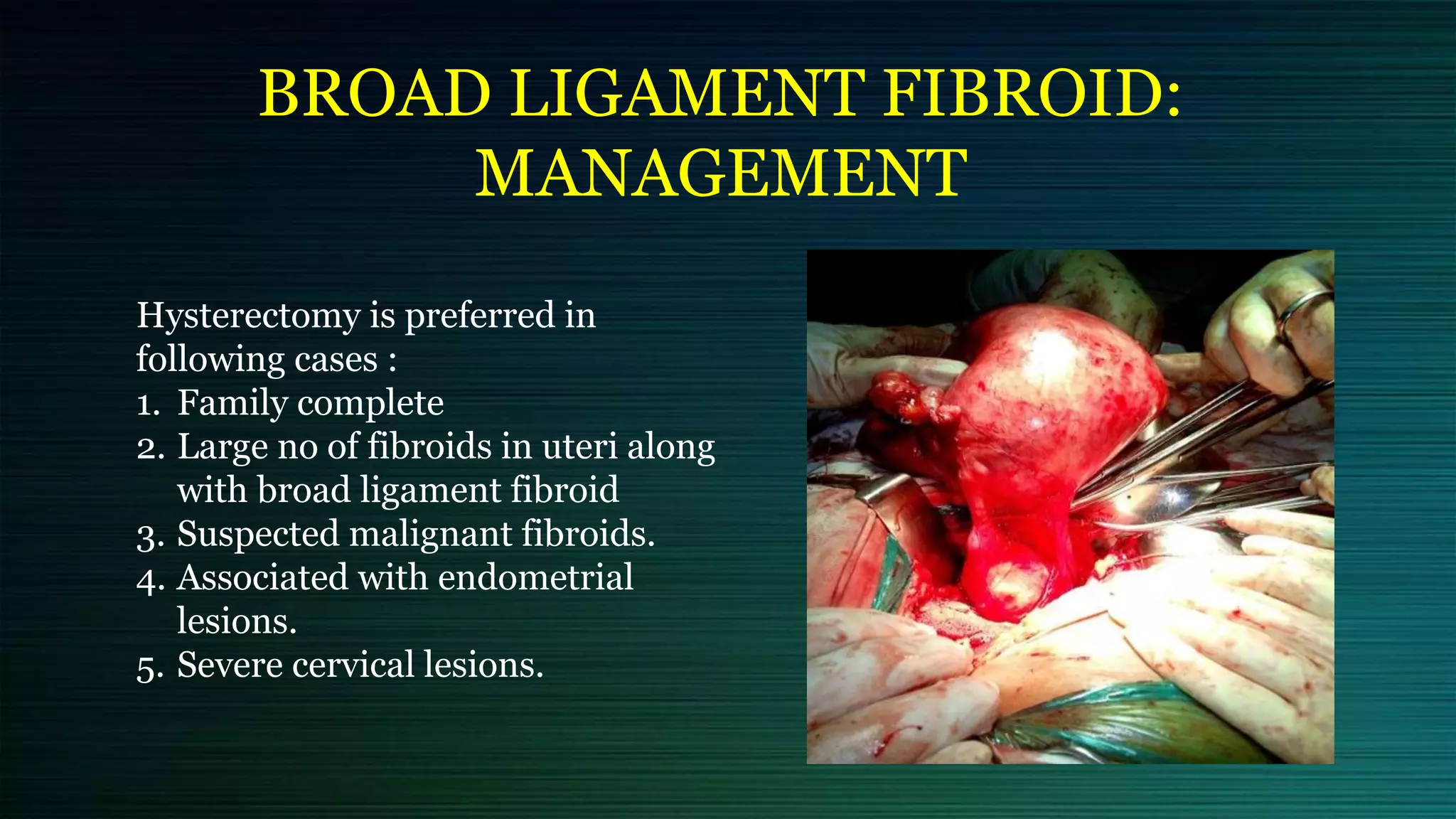 BROAD LIGAMENT FIBROID:
MANAGEMENT
Hysterectomy is preferred in
following cases :
1. Family complete
2. Large no of fibroids in uteri along
with broad ligament fibroid
3. Suspected malignant fibroids.
4. Associated with endometrial
lesions.
5. Severe cervical lesions.
 