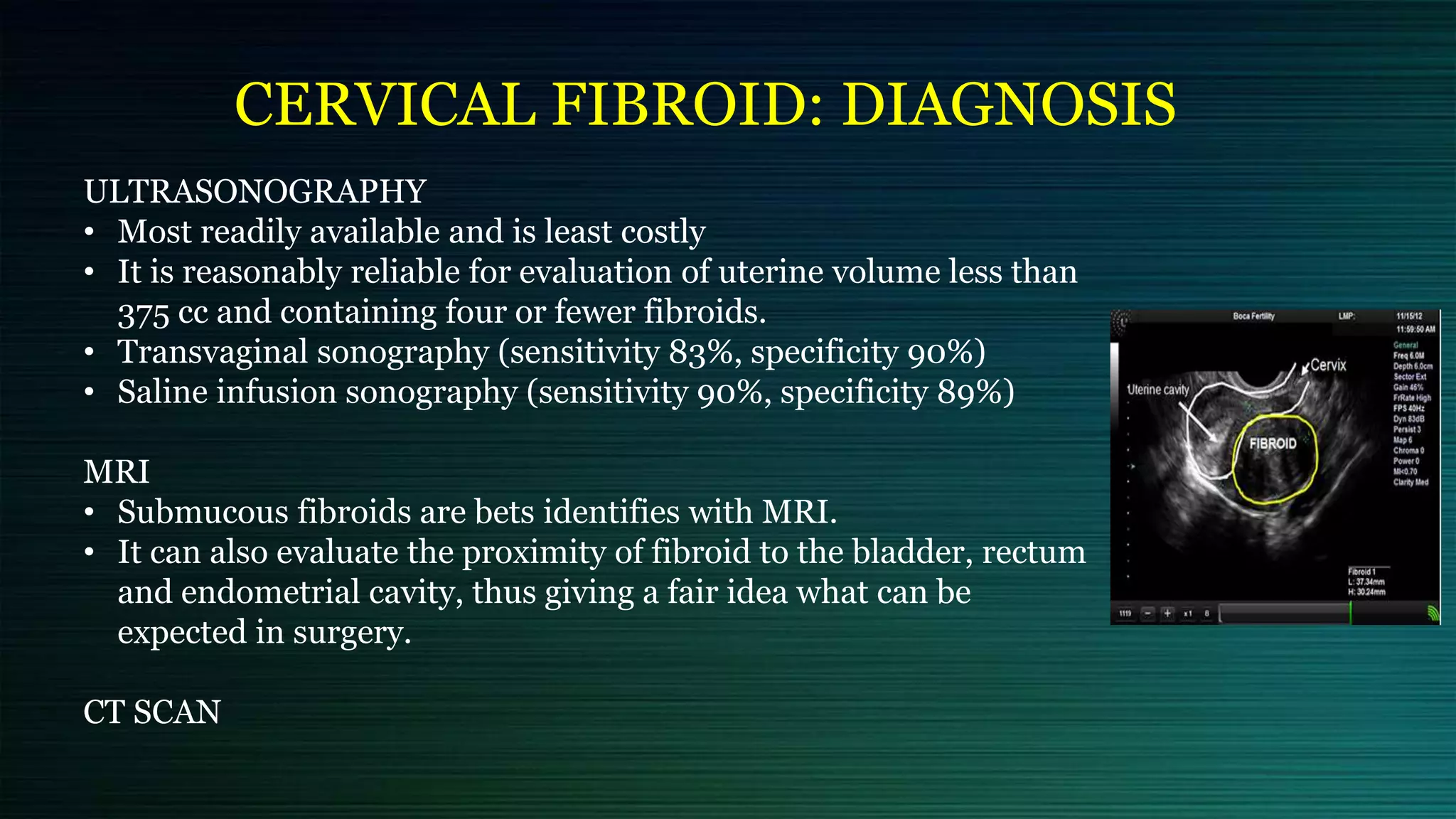 CERVICAL FIBROID: DIAGNOSIS
ULTRASONOGRAPHY
• Most readily available and is least costly
• It is reasonably reliable for evaluation of uterine volume less than
375 cc and containing four or fewer fibroids.
• Transvaginal sonography (sensitivity 83%, specificity 90%)
• Saline infusion sonography (sensitivity 90%, specificity 89%)
MRI
• Submucous fibroids are bets identifies with MRI.
• It can also evaluate the proximity of fibroid to the bladder, rectum
and endometrial cavity, thus giving a fair idea what can be
expected in surgery.
CT SCAN
 