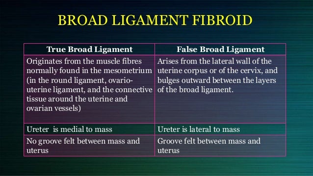 cervical and broad ligament fibroid
