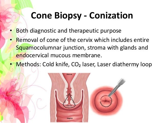 Cervical Biopsy - Obstetrics & Gynaecology Cervical Biopsy - Obstetrics & Gynaecology