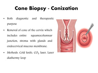 Cervical biopsy | PPTX