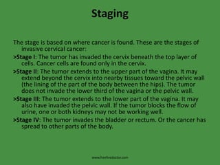 StagingThe stage is based on where cancer is found. These are the stages of invasive cervical cancer:>Stage I: The tumor has invaded the cervix beneath the top layer of cells. Cancer cells are found only in the cervix.>Stage II: The tumor extends to the upper part of the vagina. It may extend beyond the cervix into nearby tissues toward the pelvic wall (the lining of the part of the body between the hips). The tumor does not invade the lower third of the vagina or the pelvic wall.>Stage III: The tumor extends to the lower part of the vagina. It may also have invaded the pelvic wall. If the tumor blocks the flow of urine, one or both kidneys may not be working well.>Stage IV: The tumor invades the bladder or rectum. Or the cancer has spread to other parts of the body.www.freelivedoctor.com