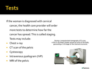 If the woman is diagnosed with cervical
cancer, the health care provider will order
more tests to determine how far the
cancer has spread.This is called staging.
Tests may include:
 Chest x-ray
 CT scan of the pelvis
 Cystoscopy
 Intravenous pyelogram (IVP)
 MRI of the pelvis
 