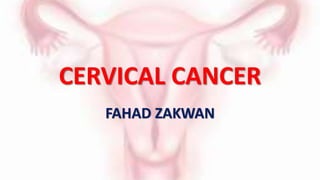 CERVICAL CANCER
FAHAD ZAKWAN
 