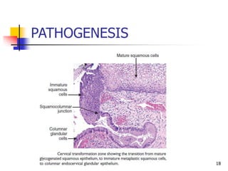 PATHOGENESIS
18
 
