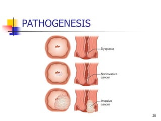 PATHOGENESIS
20
 