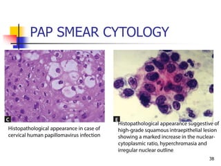 PAP SMEAR CYTOLOGY
38
 