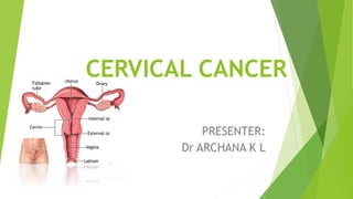 CERVICAL CANCER
PRESENTER:
Dr ARCHANA K L
 