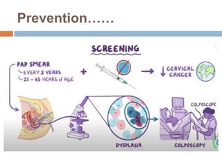 Prevention……
 