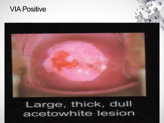 VIA Positive
 