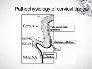 Pathophysiology of cervical cancer
 