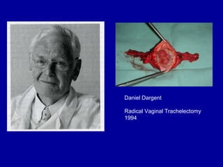 Daniel Dargent Radical Vaginal Trachelectomy 1994 