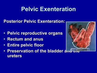 Pelvic Exenteration Posterior Pelvic Exenteration: Pelvic reproductive organs Rectum and anus Entire pelvic floor Preservation of the bladder and the ureters 