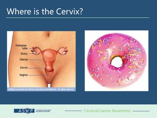 Where is the Cervix?
 