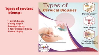 Types of cervical
biopsy :
1- punch biopsy
2- Ring biopsy
3- wedge biopsy
4- four quadrant biopsy
5- cone biopsy
 
