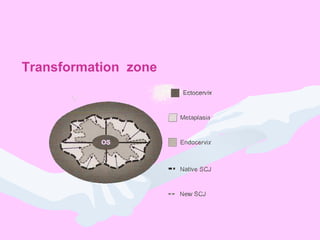 Transformation zone
 