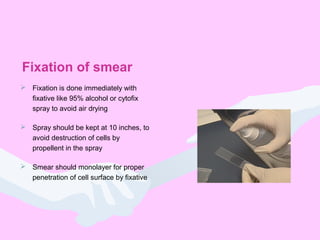 Fixation of smear
 Fixation is done immediately with
fixative like 95% alcohol or cytofix
spray to avoid air drying
 Spray should be kept at 10 inches, to
avoid destruction of cells by
propellent in the spray
 Smear should monolayer for proper
penetration of cell surface by fixative
 
