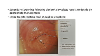 • Secondary screening following abnormal cytology results to decide on
appropriate management
• Entire transformation zone should be visualized
 