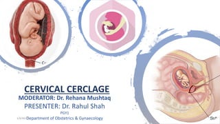 CERVICAL CERCLAGE
MODERATOR: Dr. Rehana Mushtaq
PRESENTER: Dr. Rahul Shah
PGY1
Department of Obstetrics & Gynaecology
1/9/2024
 