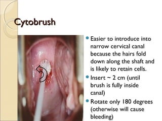 CCyyttoobbrruusshh 
Easier to introduce into 
narrow cervical canal 
because the hairs fold 
down along the shaft and 
is likely to retain cells. 
Insert ~ 2 cm (until 
brush is fully inside 
canal) 
Rotate only 180 degrees 
(otherwise will cause 
bleeding) 
 