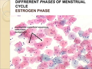 DIFFRERENT PHASES OF MENSTRUAL 
CYCLE 
ESTROGEN PHASE 
eosinophilic superficial squamous 
cells, clean 
background 
. 
dr. monika nema 
 