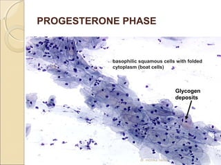 . ( PROGESTERONE PHASE 
basophilic squamous cells with folded 
cytoplasm (boat cells) 
Glycogen 
deposits 
dr. monika nema 
 