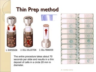 TThhiinn PPrreepp mmeetthhoodd 
The entire procedure takes about 70 
seconds per slide and results in a thin 
deposit of cells in a circle 20 mm in 
diameter. 
dr. monika nema 
 