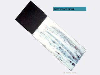 Conventional smear 
dr. monika nema 
 