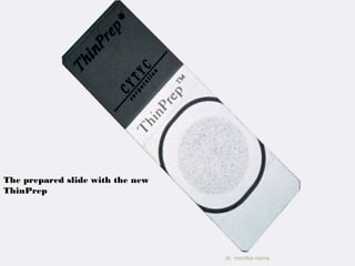 The prepared slide with the new 
ThinPrep 
dr. monika nema 
 