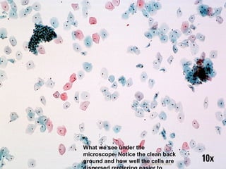 What we see under the 
microscope. Notice the clean back 
ground and how well the cells are 
dispersed rendering easier dr. monika to 
nema 
 