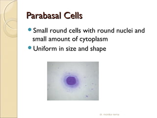 PPaarraabbaassaall CCeellllss 
Small round cells with round nuclei and 
small amount of cytoplasm 
Uniform in size and shape 
dr. monika nema 
 