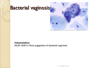 BBaacctteerriiaall vvaaggiinnoossiiss 
Interpretation: 
NILM: Shift in Flora suggestive of bacterial vaginosis 
dr. monika nema 
 