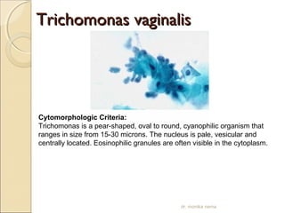 TTrriicchhoommoonnaass vvaaggiinnaalliiss 
Cytomorphologic Criteria: 
Trichomonas is a pear-shaped, oval to round, cyanophilic organism that 
ranges in size from 15-30 microns. The nucleus is pale, vesicular and 
centrally located. Eosinophilic granules are often visible in the cytoplasm. 
dr. monika nema 
 
