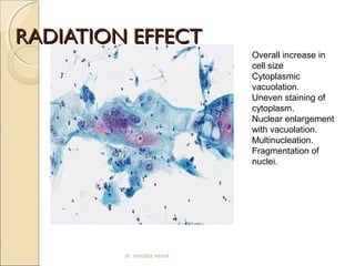 RRAADDIIAATTIIOONN EEFFFFEECCTT 
Overall increase in 
cell size 
Cytoplasmic 
vacuolation. 
Uneven staining of 
cytoplasm. 
Nuclear enlargement 
with vacuolation. 
Multinucleation. 
Fragmentation of 
nuclei. 
dr. monika nema 
 