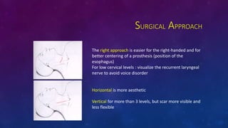 SURGICAL APPROACH
The right approach is easier for the right-handed and for
better centering of a prosthesis (position of the
esophagus)
For low cervical levels : visualize the recurrent laryngeal
nerve to avoid voice disorder
Horizontal is more aesthetic
Vertical for more than 3 levels, but scar more visible and
less flexible
 