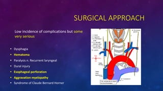 SURGICAL APPROACH
Low incidence of complications but some
very serious
? Dysphagia
? Hematoma
? Paralysis n. Recurrent laryngeal
? Dural injury
? Esophageal perforation
? Aggravation myelopathy
? Syndrome of Claude Bernard Horner
 