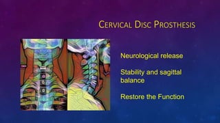 CERVICAL DISC PROSTHESIS
Neurological release
Stability and sagittal
balance
Restore the Function
 