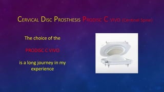 CERVICAL DISC PROSTHESIS PRODISC C VIVO (Centinel Spine)
The choice of the
PRODISC C VIVO
is a long journey in my
experience
 